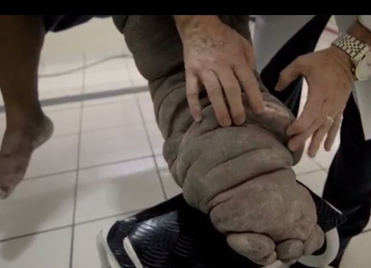 elephant leg 